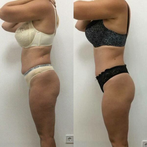 145fbe71f1e24a5792caea4f957cc277