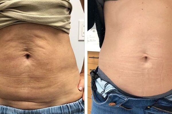 7b46acb7de6dac27992f8b3532e02744