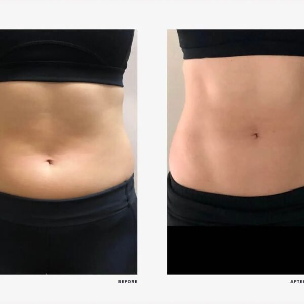 8c2fbb9943a03ff2afbf28525d89e1e1