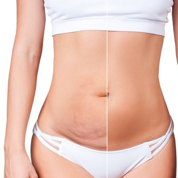 ce0dee1bb53208bf36090c80f70e249f